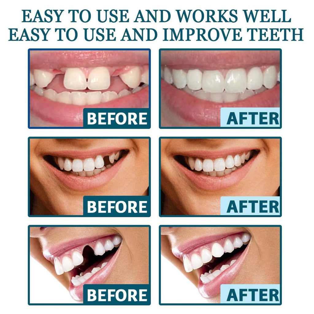 Clip on Veneers Silicone Kit for Both Upper and Lower (3Set) S3403