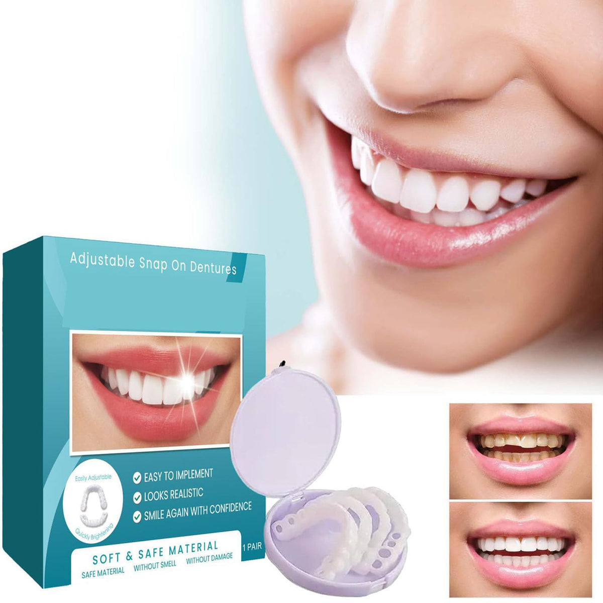 Clip on Veneers Silicone Kit for Both Upper and Lower (3Set) S3403